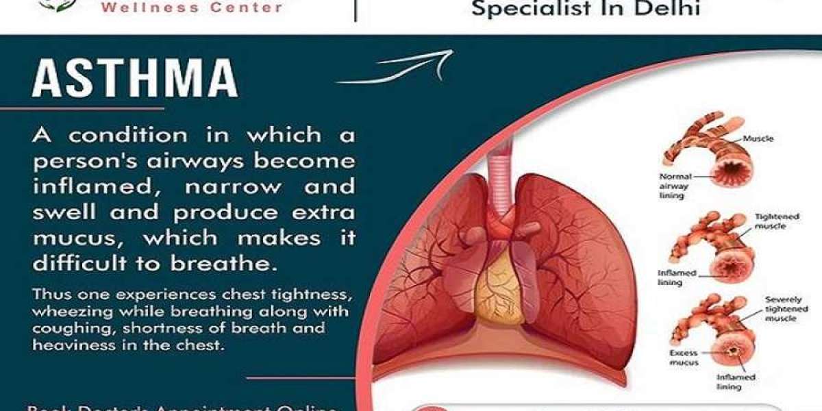 Get Relief from Persistent Asthma with Dr. Sanchayan Roy: The Best Asthma Specialist