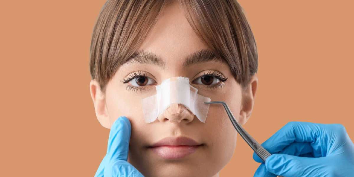 Best Septoplasty Surgeons in Dubai: Advanced Care for Better Breathing