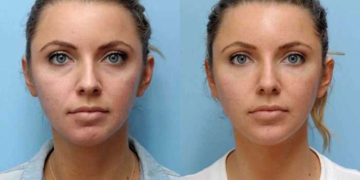 Article Picture