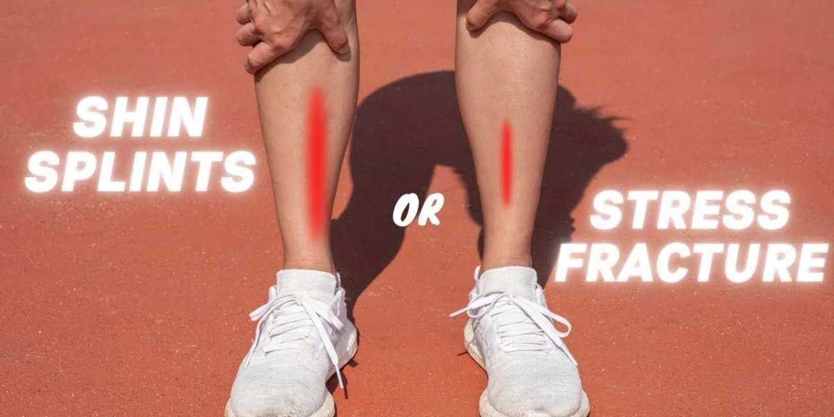 When to Stop Running: Shin Splints or Stress Fracture?