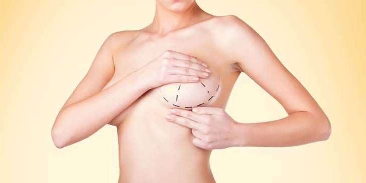 Breast Augmentation in Dubai: Natural-Looking Results with Modern Implants
